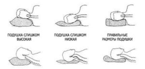 Как правильно выбрать ортопедическую подушку?